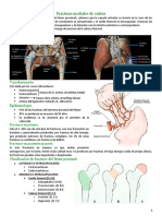 Fracturas de Cadera