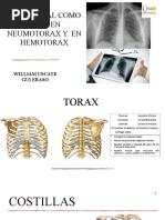 Reja Costal Laboratorio-Diapositivas