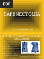 SAFENECTOMIA