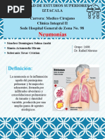 Neumonia