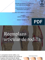 Reemplazo de Rodilla