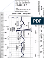 Tabla de EKG