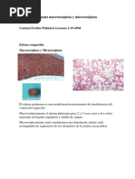 Pulmón Imágenes Macroscópicas y Microscópicas