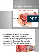 Fistula Genetalia