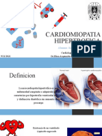 Cardiomiopatia Hipertrofica