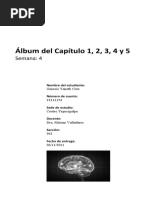 Bases Biologicas - Tarea 3 (Semana 4) - Tarea Final