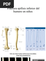 Fractura Epífisis Inferior Del Humero en Niños - Cajas Montenegro