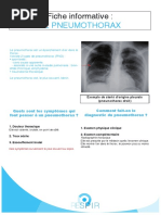 Fiche Pneumothorax