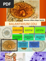 Balantidium Coli