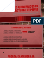 Abordajes Quirurgicos en Las Fracturas de Pelvis