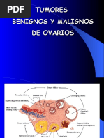 Tumores Benignos y Malignos de Ovario 1228447832478194 8