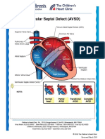 Atrioventricular Septal Defect Avsd Complete