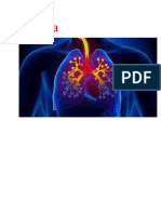 Case Study On Asthma