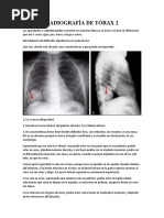 Radiografía de Tórax 2