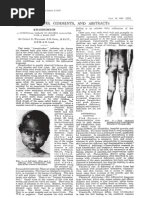 Kwashiorkor