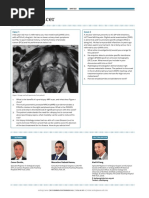 Prostate Cancer: Case 1 Case 2