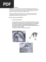 Anestesia Infiltrativa