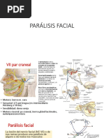 Parálisis Facial Caso Clinico