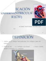 Comunicacion Interventricular