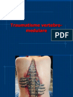 Traumatisme Vertebro-Medulare