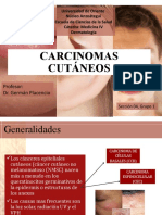 Carcinomas Cutaneos