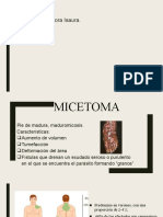 MICETOMA