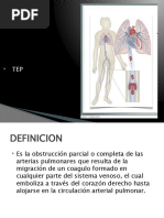 Tromboembolismo Pulmonar