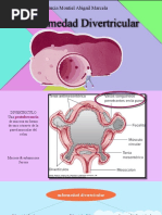 Enf Divertricular