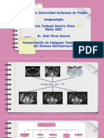 Interpretación de Imágenes Tomográficas Del Sistema Genitourinario