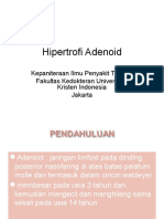 Hipertrofi Adenoid