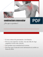 Contractura Muscular