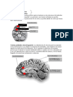 Areas Dañadas - Caso Phineas Gage