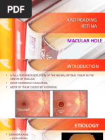 Macular Hole Aao Reading Retina Viv