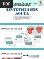 4 Diverticulitis Aguda