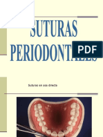 SUTURAS