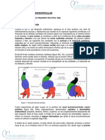 Comunicacion Interventricular