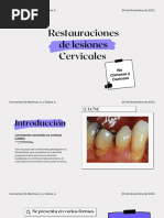 Restauraciones de Lesiones Cervicales