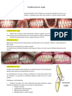 Clasificación de Angle