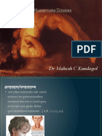 Dhanusthamba/Dhanurvata/Tetanus: Dr. Mahesh C Kundagol