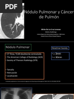 Nódulo Pulmonar y Cáncer de Pulmón