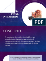 Vigilancia Fetal Intraparto