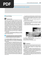 Clavicle and Sternoclavicular Joint