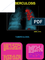 Tuberculosis