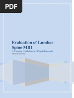 Evaluation of Lumbar Spine MRI