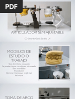 Montaje de Modelos en Articulador Semiajustable Con Programación Condilar