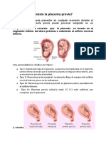 Placenta Previa