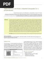 Applications of Cone Beam Computed Tomography For A ProsthodontistJIPS-16-3