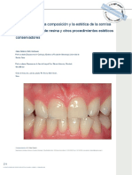 Optimización de La Composición y La Estética de La Sonrisa Dietschi