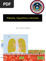 Hipoxia, Isquemia y Necrosis