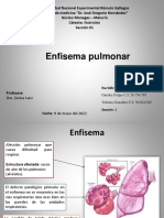 Enfisema Pulmonar